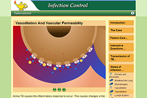 illustration of white blood cells entering a capillary at the site of infection